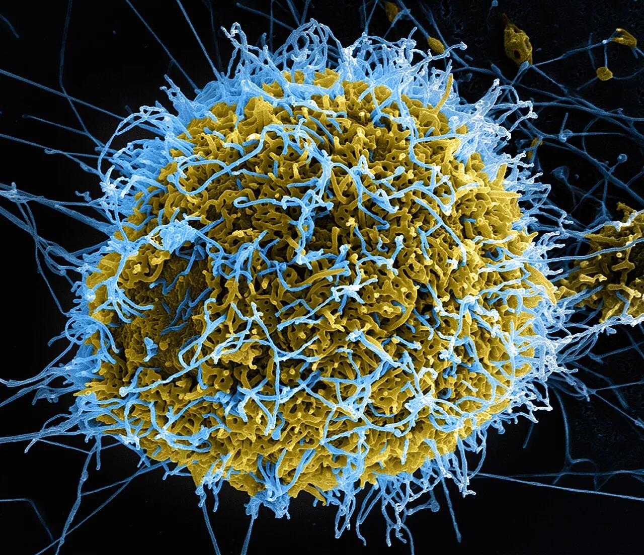 Colourised electron micrograph of Ebola virus particles (in blue) budding from an infected cell, made at a NIAID laboratory in the United States in 2014.
