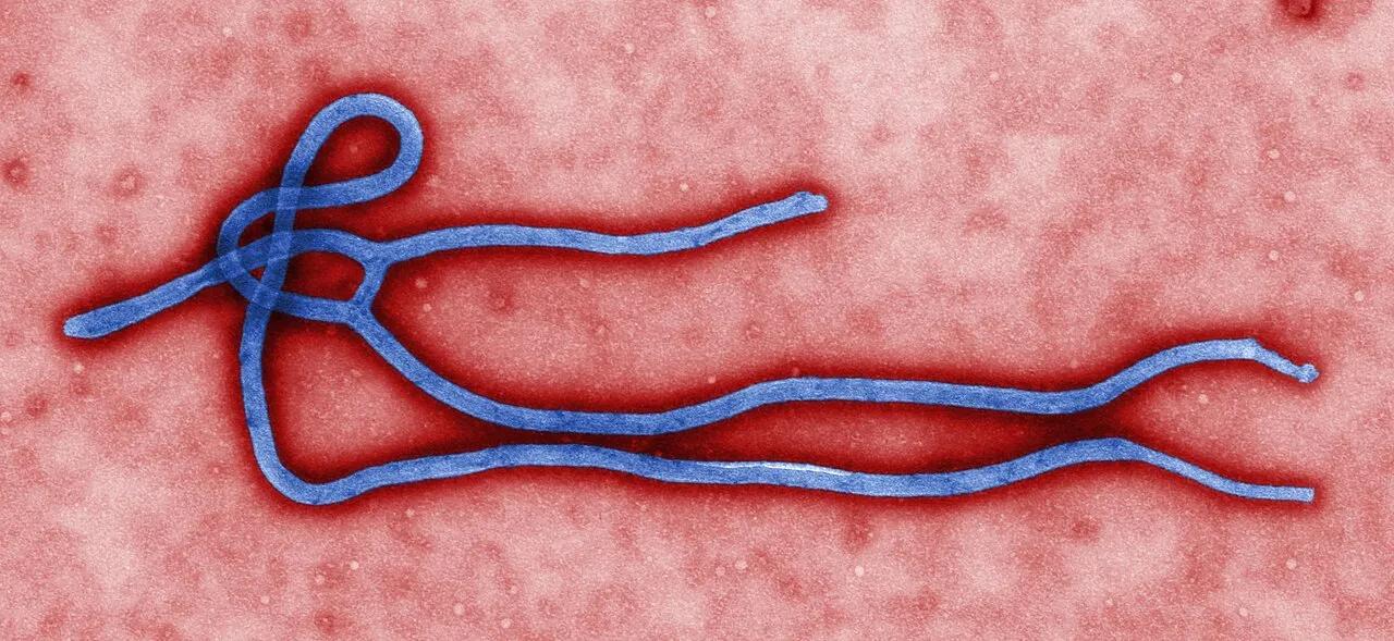 Micrografia eletrônica colorizada de uma partícula do vírus Ebola, produzida nos laboratórios do CDC, a agência de saúde pública dos Estados Unidos.