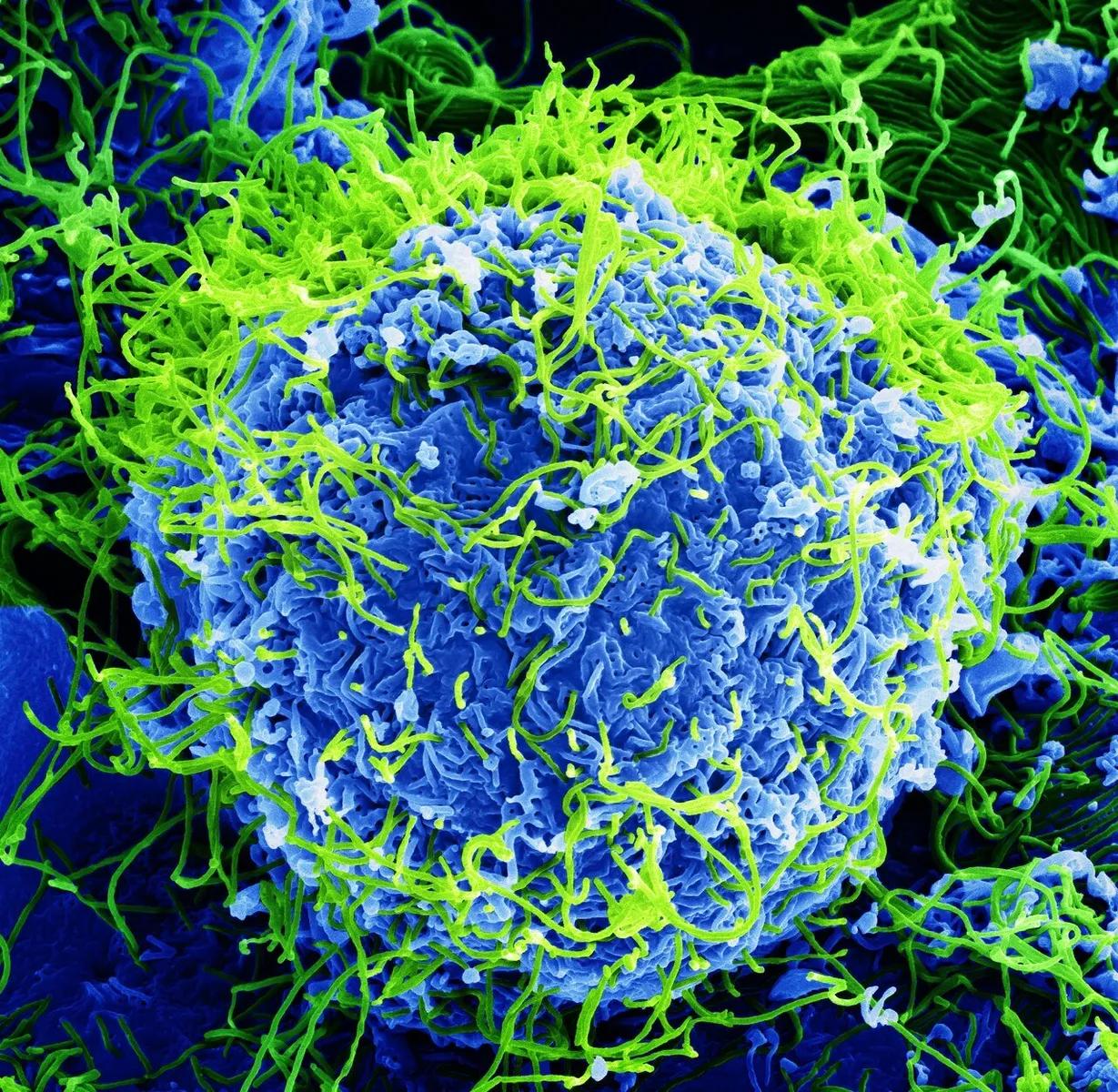 Micrografía electrónica de barrido coloreada de partículas del virus del ébola (en verde) saliendo de una célula infectada, en una imagen de 2014.